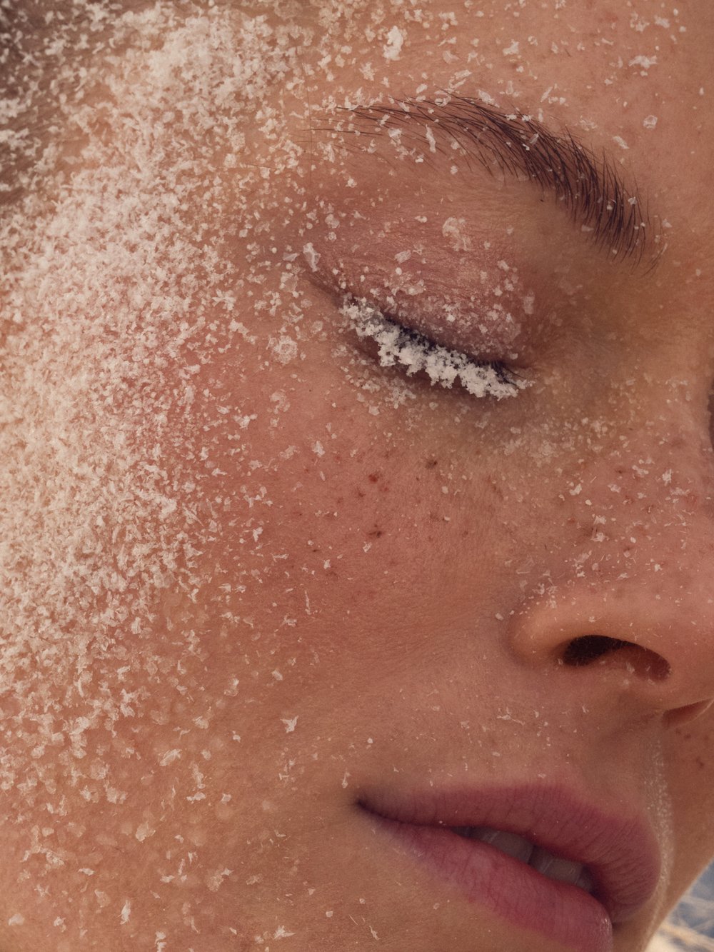 Winter care